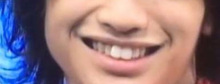 中島健人の前歯が可愛いと話題に 綺麗な歯は矯正していた